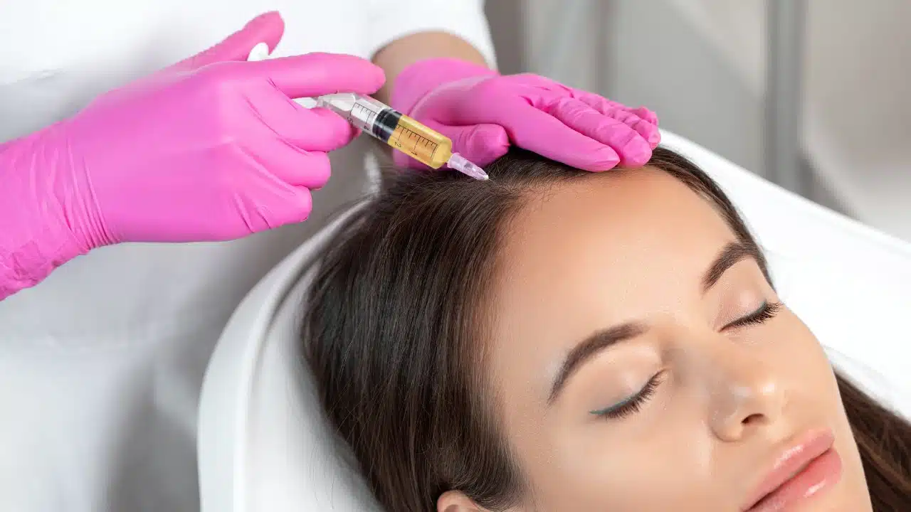 Is PRP Hair Loss Treatment Covered by Insurance PRP Treatment